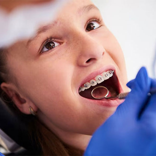 Ortodontia - Aparelho Corretivo